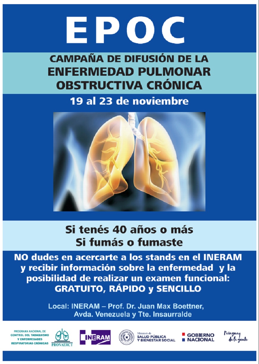 EPOC Inicia semana de prevención de la enfermedad pulmonar obstructiva